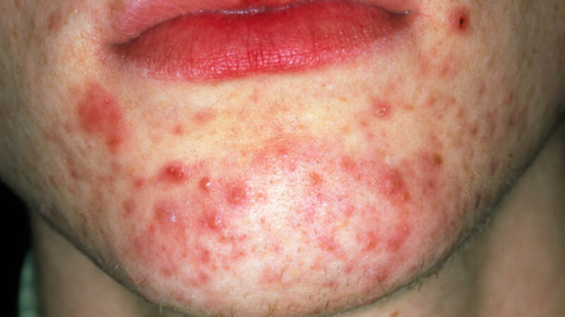 ca_ss_sb22223_121380