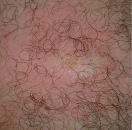 After-Mladeži na telu