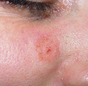 After-Mladeži na licu